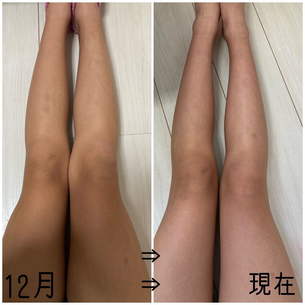 寝ながらメディキュット ロング/メディキュット/着圧ソックス・レギンスを使ったクチコミ（2枚目）