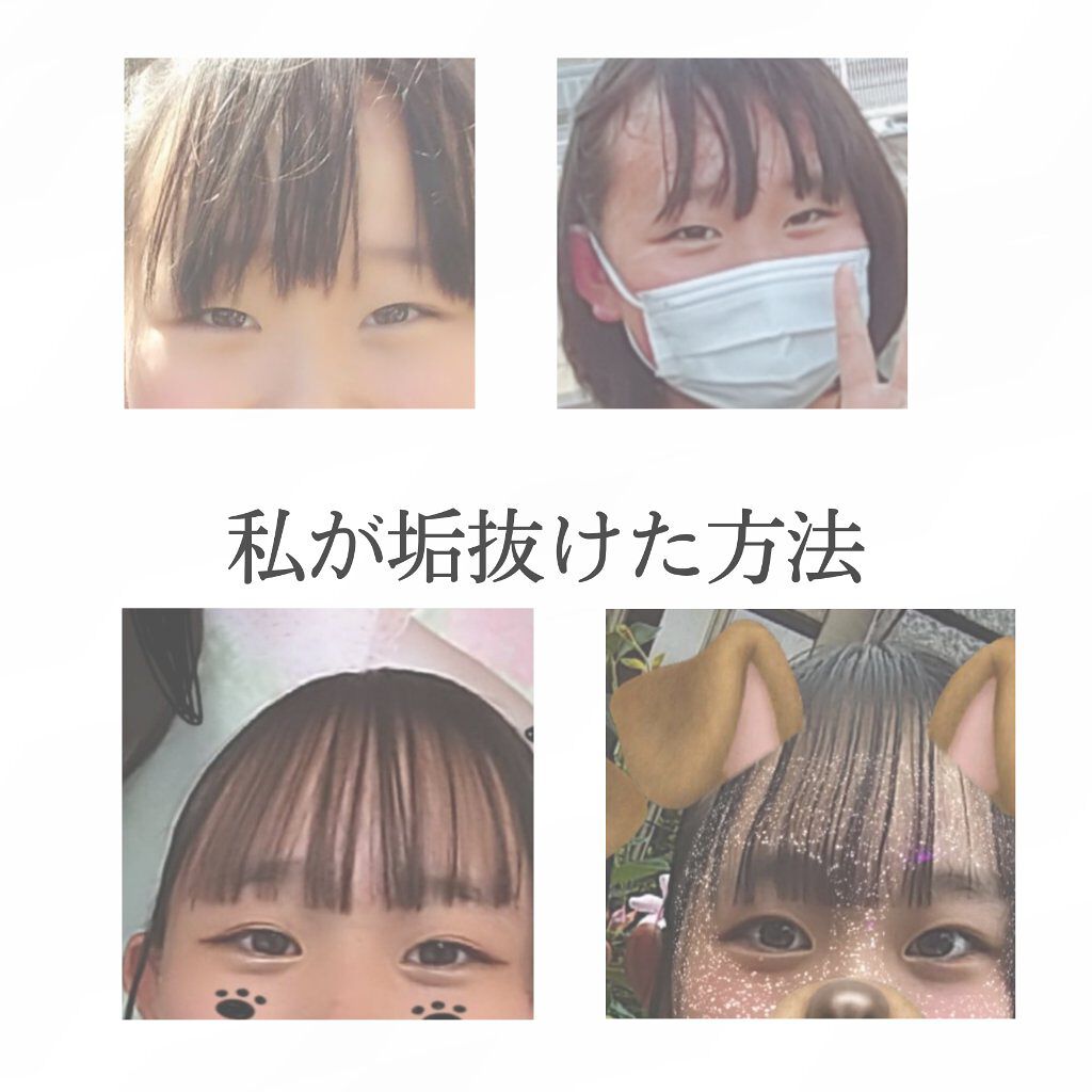 のびーるアイテープ（絆創膏タイプ、レギュラー）/DAISO/二重まぶた用アイテムを使ったクチコミ（1枚目）