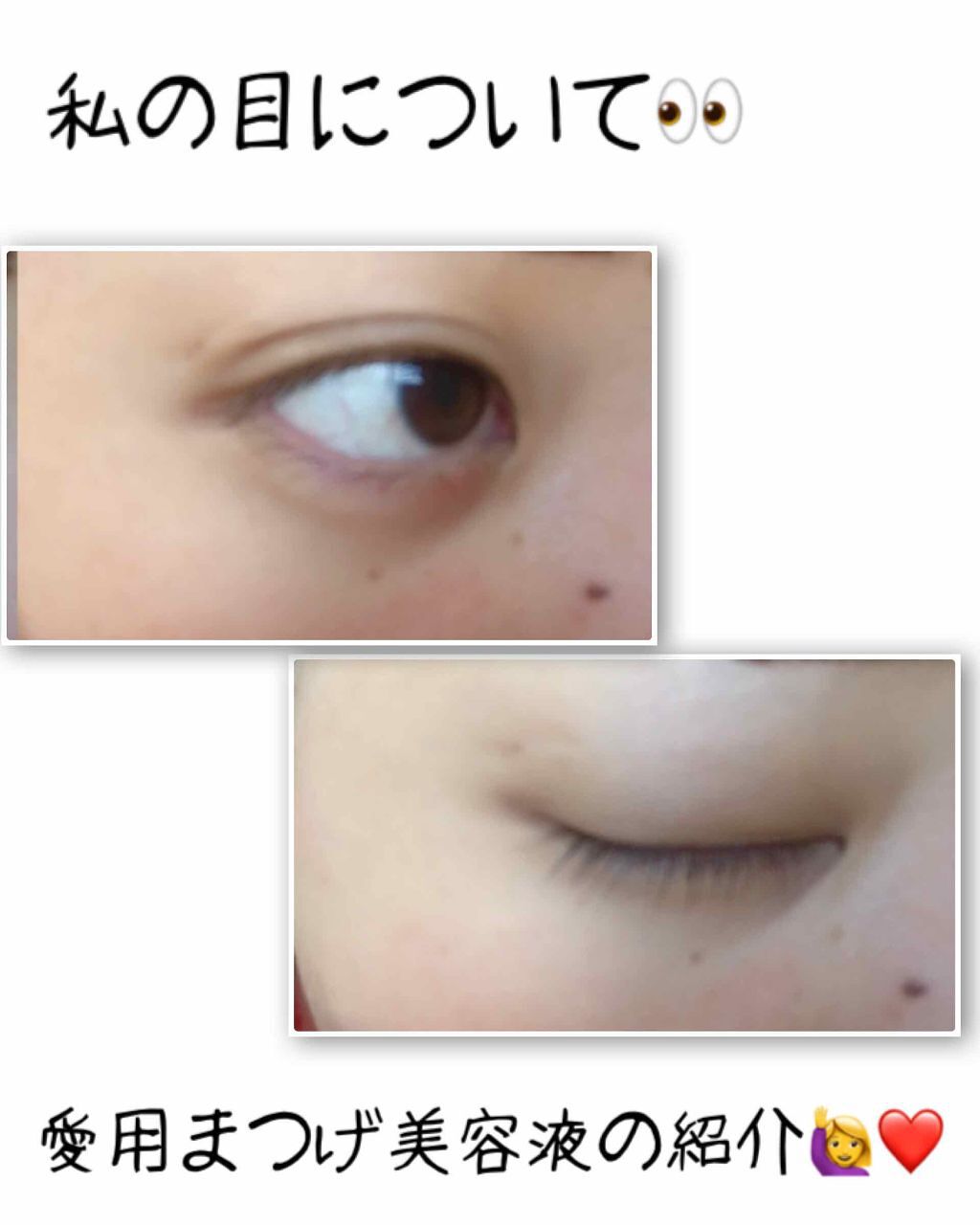 エクストラ オーディナリー ラッシュ セラム/ロレアル パリ/まつげ美容液を使ったクチコミ(1枚目)