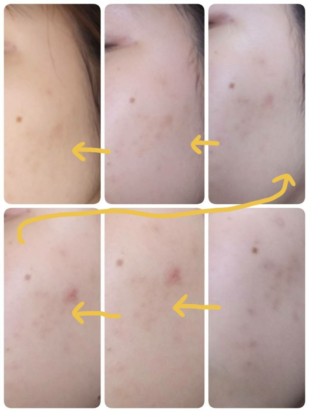 薬用しみ対策 美白化粧水/メラノCC/化粧水を使ったクチコミ（2枚目）