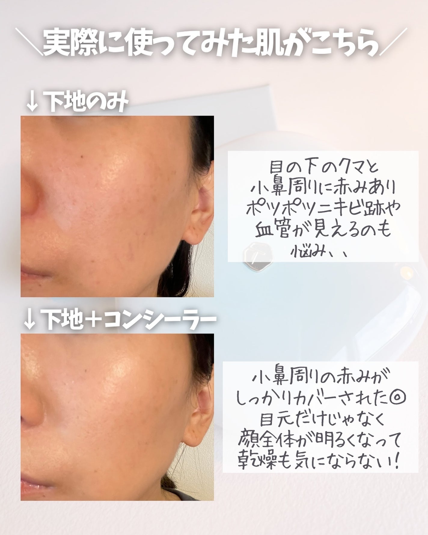 TIMAGE  クリーミーコンシーラーパレット/TIMAGE/パレットコンシーラーを使ったクチコミ(5枚目)