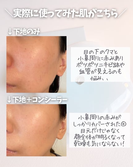 TIMAGE  クリーミーコンシーラーパレット/TIMAGE/パレットコンシーラーを使ったクチコミ(5枚目)