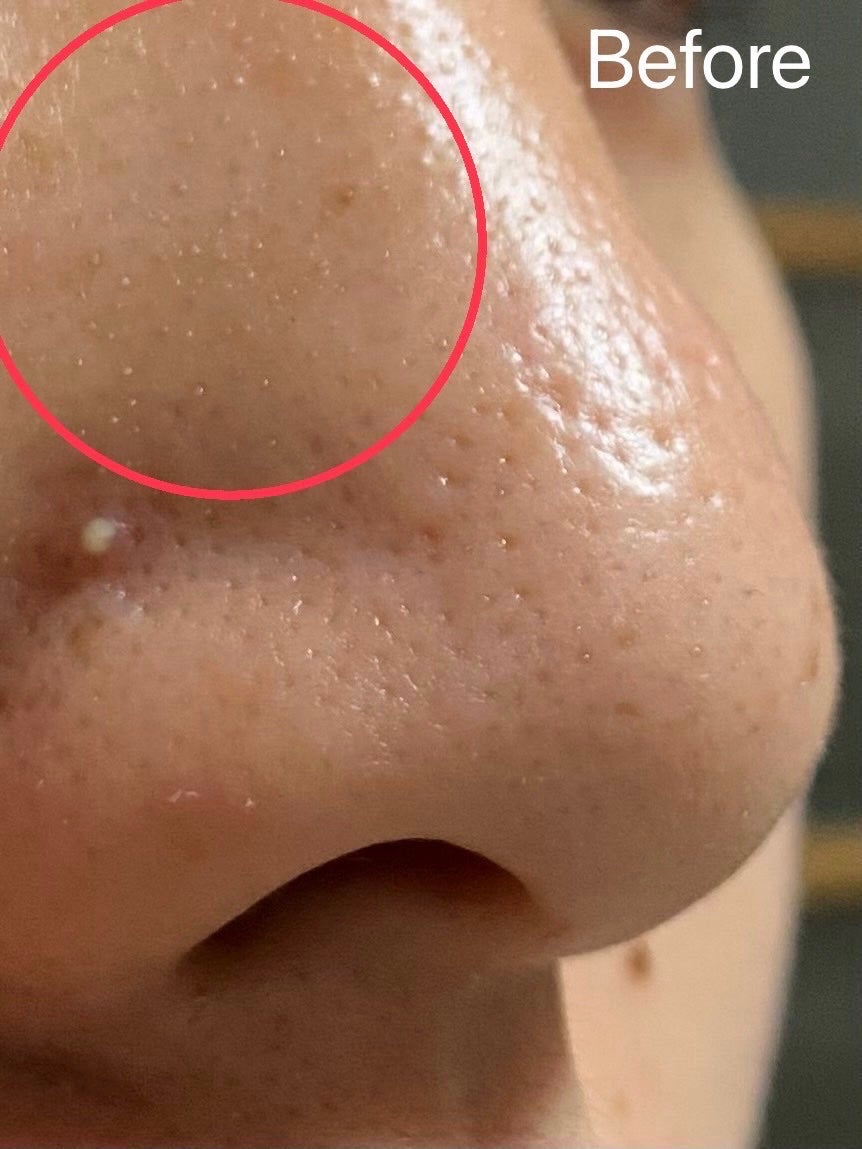 パーフェクトワンフォーカス スムースクレンジングバーム ディープブラック/PERFECT ONE FOCUS/クレンジングバームを使ったクチコミ(5枚目)