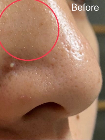 パーフェクトワンフォーカス スムースクレンジングバーム ディープブラック/PERFECT ONE FOCUS/クレンジングバームを使ったクチコミ(5枚目)