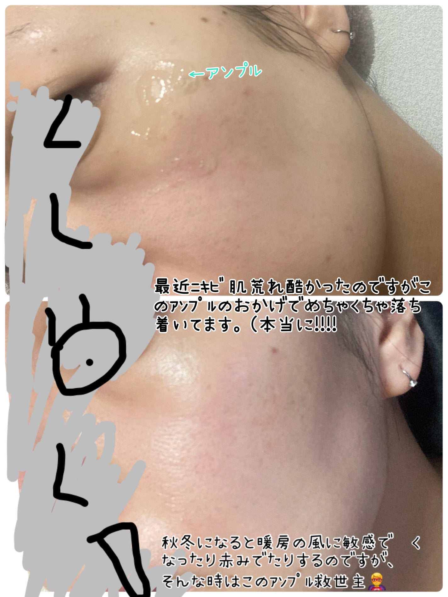 エクソソームシカセラム/MEDICUBE/美容液を使ったクチコミ(3枚目)