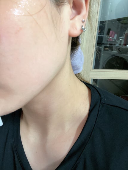 アビブ グルタチオンソームダークスポットセラムビタドロップ/Abib /美容液を使ったクチコミ(7枚目)