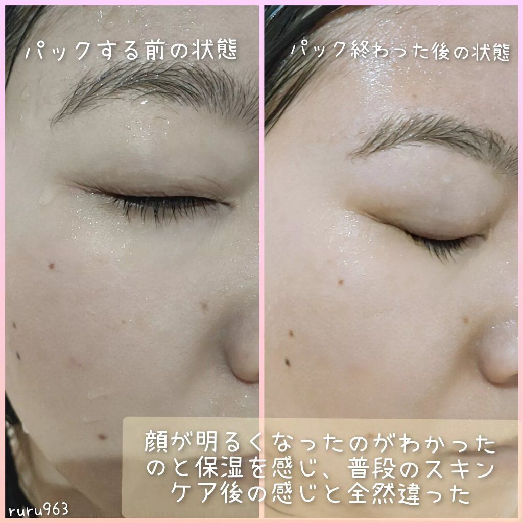 スパークリングジェルパック/antube/洗い流すパック・マスクを使ったクチコミ(5枚目)