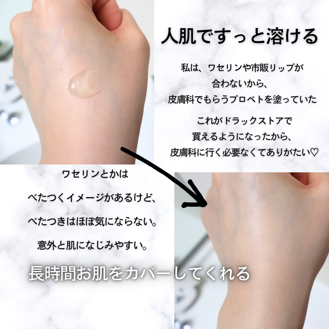 ピュアベール(医薬品)/プロペト/その他を使ったクチコミ（3枚目）