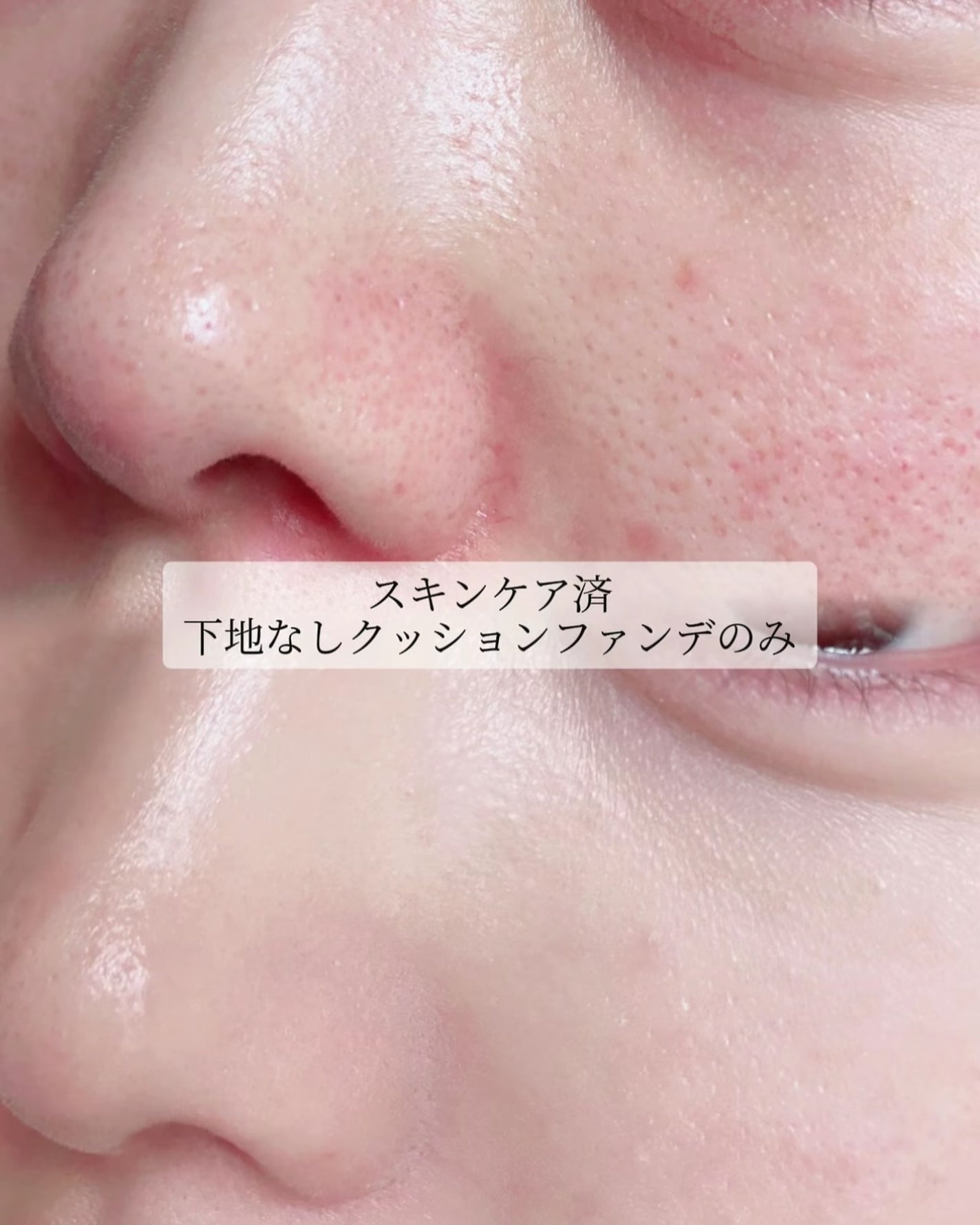 Skin Barrier Calming Lotion/Ongredients/乳液を使ったクチコミ(4枚目)