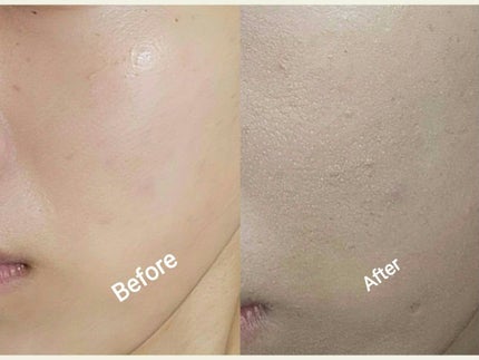 キル カバー ファンウェア クッション ザ オリジナル/CLIO/クッションファンデーションを使ったクチコミ(10枚目)