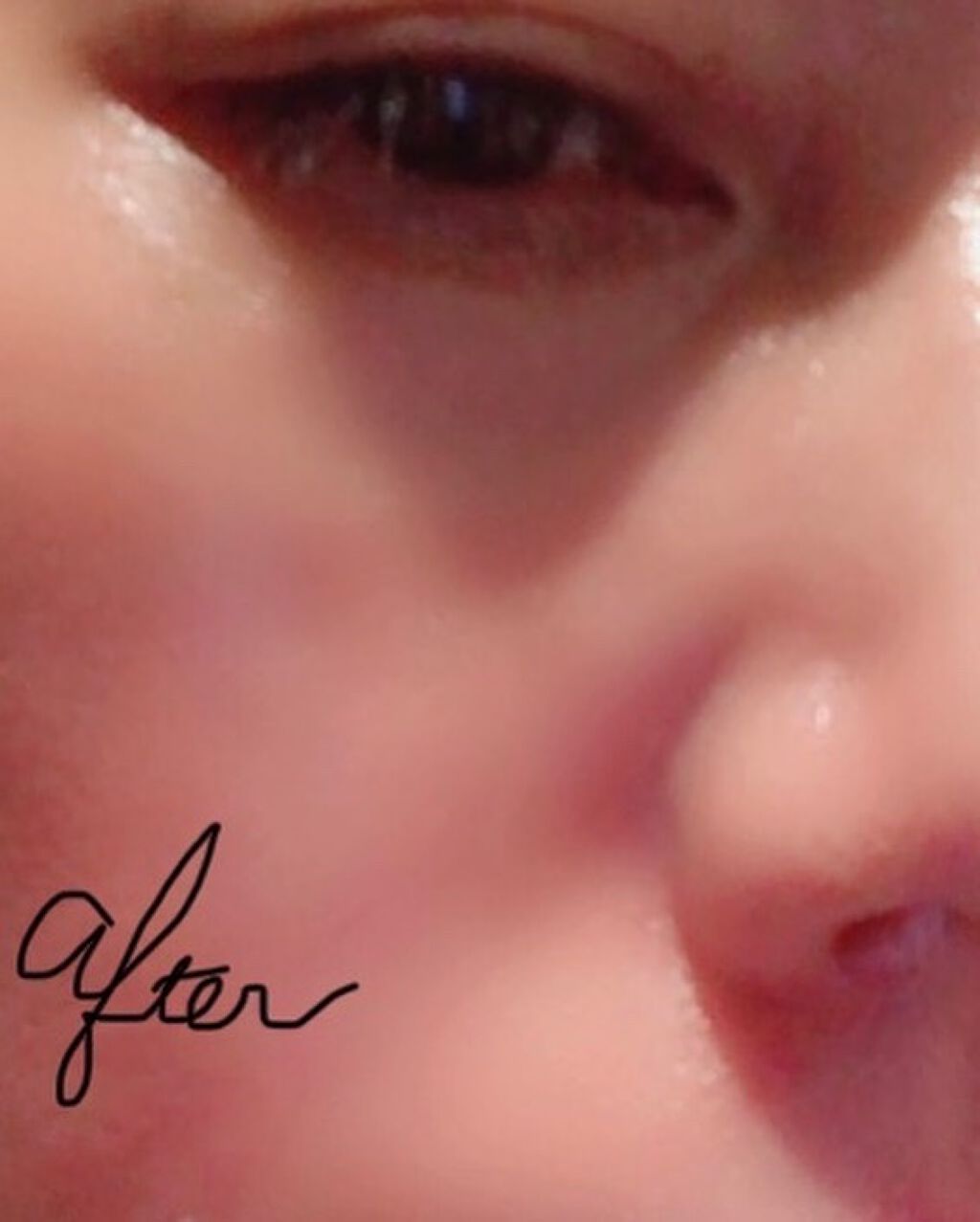 ビタオンチアフルミスト/VITAON/ミスト状化粧水を使ったクチコミ（3枚目）