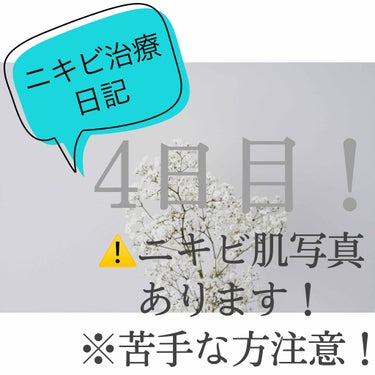 ディフェリンゲル0.1% /マルホ株式会社/その他を使ったクチコミ（1枚目）