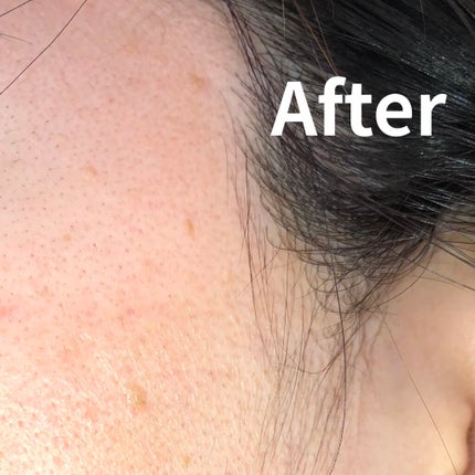 メラノショット ホワイト D/ONE BY KOSE/美容液を使ったクチコミ(4枚目)