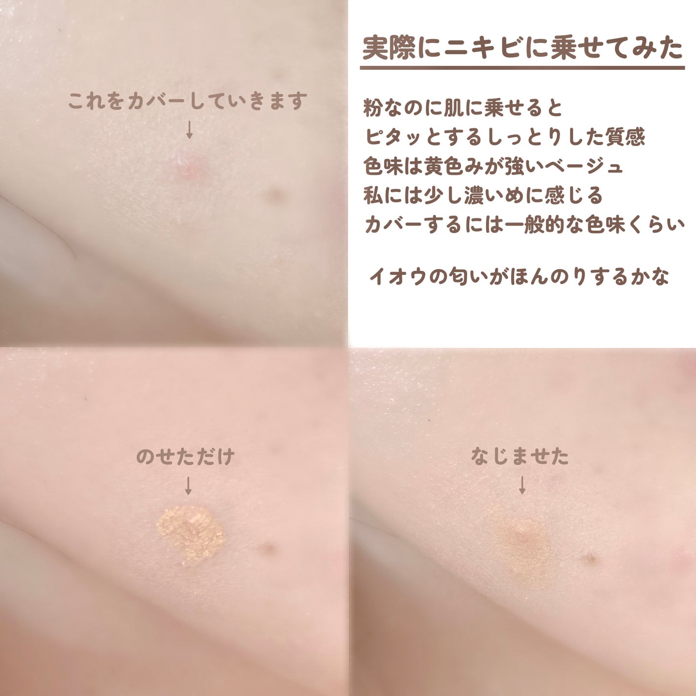 薬用コンシーラー アクネプロテクター/ONLY MINERALS/パウダーコンシーラーを使ったクチコミ(9枚目)