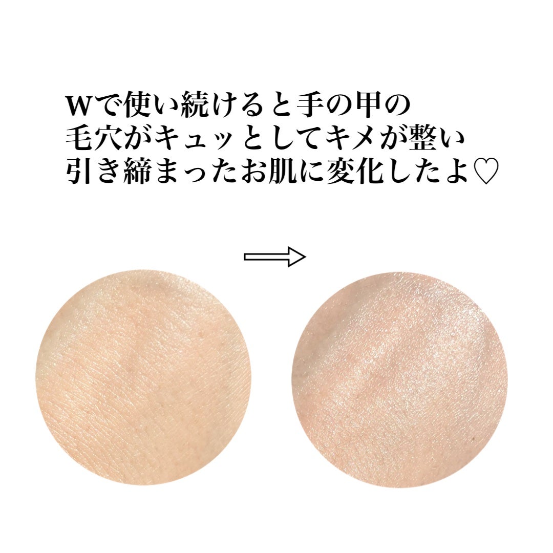 リードルショット300/VT/美容液を使ったクチコミ(8枚目)