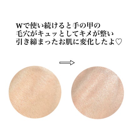 リードルショット300/VT/美容液を使ったクチコミ(8枚目)