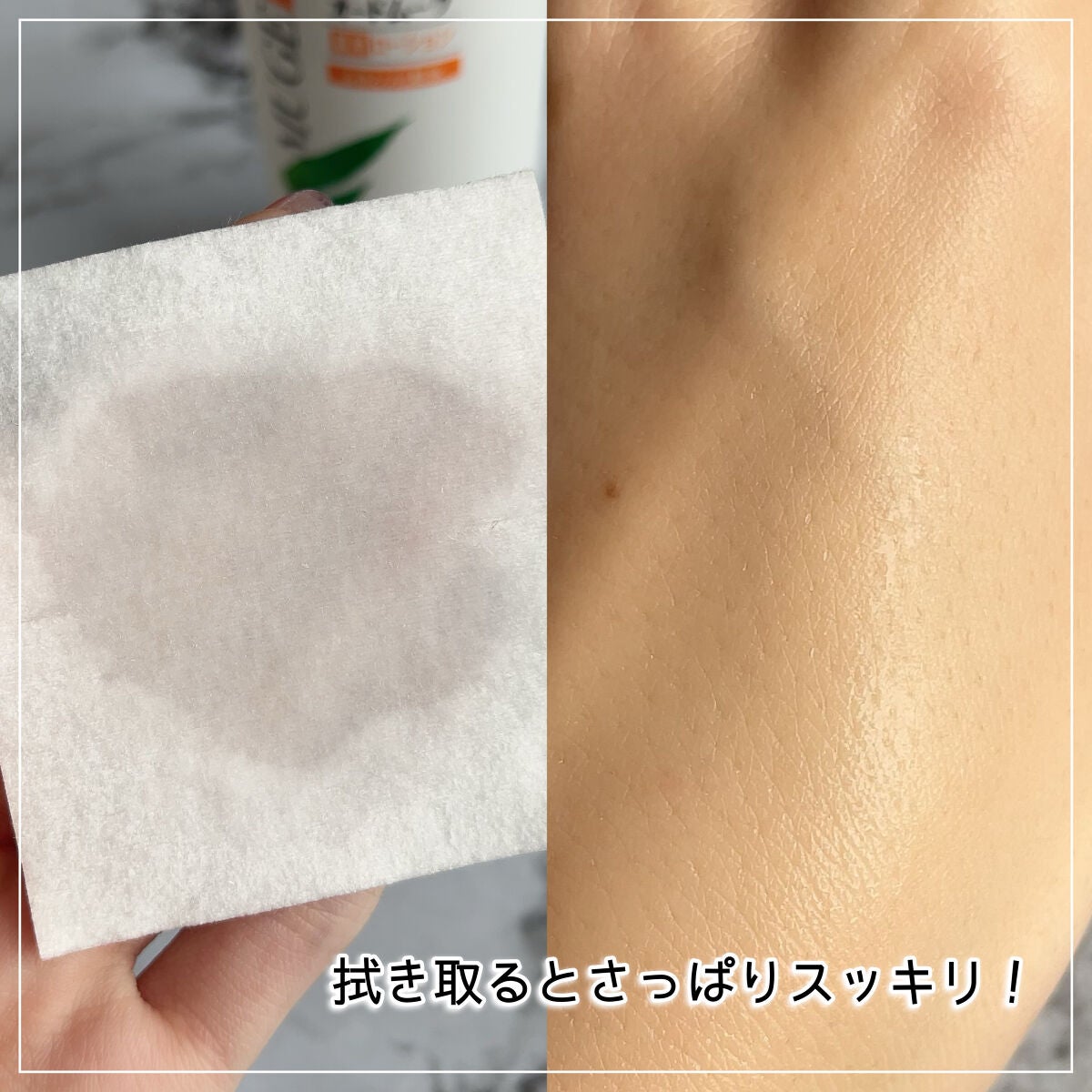 オードムーゲ 薬用ローション(ふきとり化粧水)/オードムーゲ/拭き取り化粧水を使ったクチコミ(5枚目)