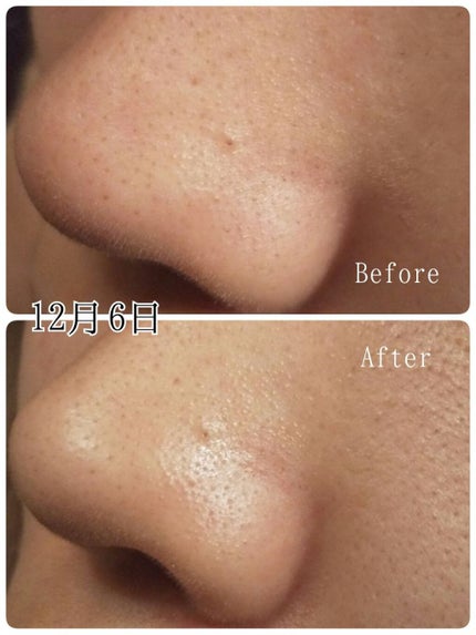 パワーマスク SP/ラッシュ/スクラブ・ゴマージュを使ったクチコミ(5枚目)