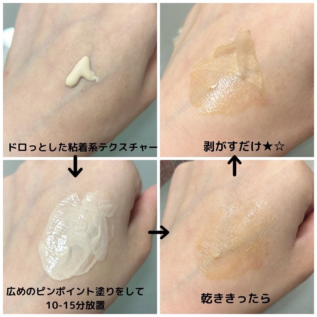 レディブラン 薬用美白シミキールパックC/シーヴァ/ピーリングを使ったクチコミ(3枚目)