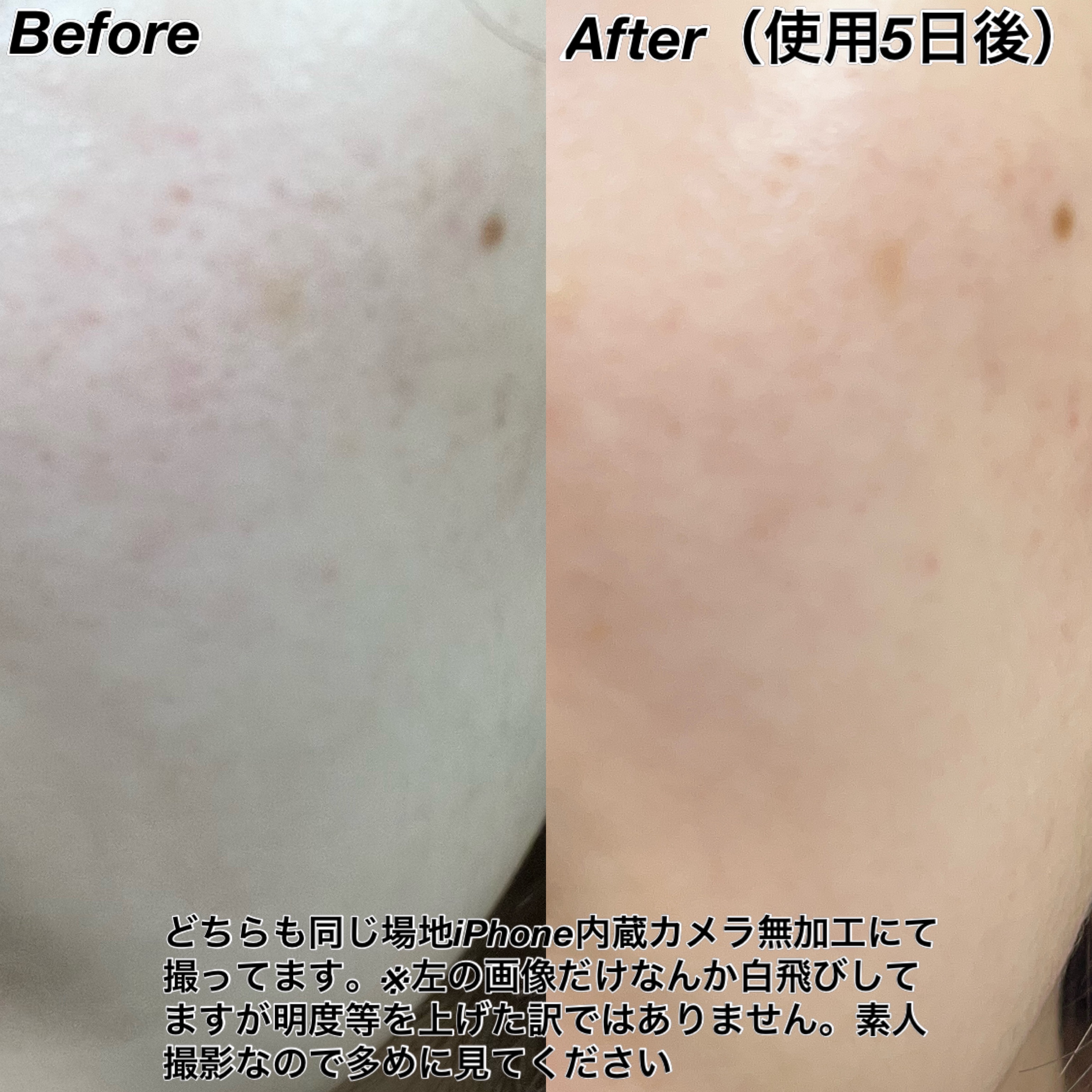 ポアタイトニングブーストセラム/CELORABY/美容液を使ったクチコミ（3枚目）