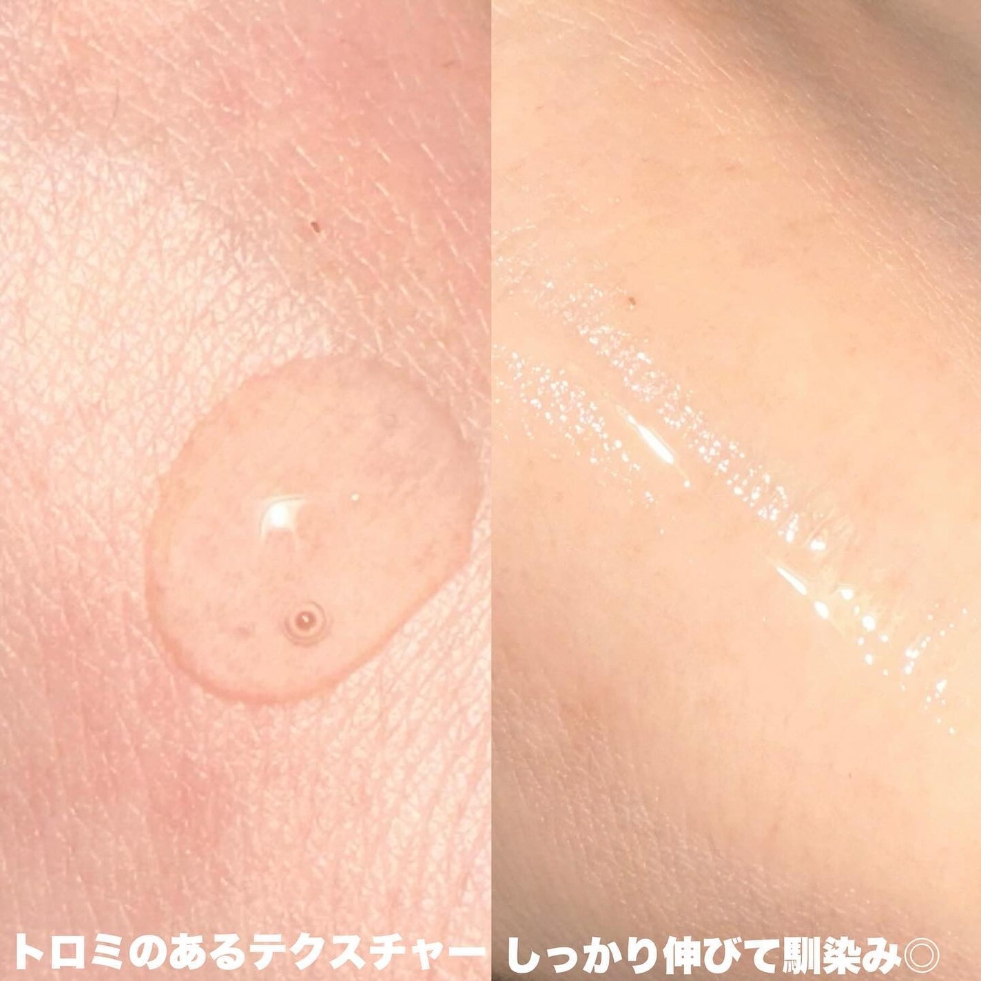 モイスチャートリートメントアンプル/REJURAN COSMETICS/美容液を使ったクチコミ(3枚目)