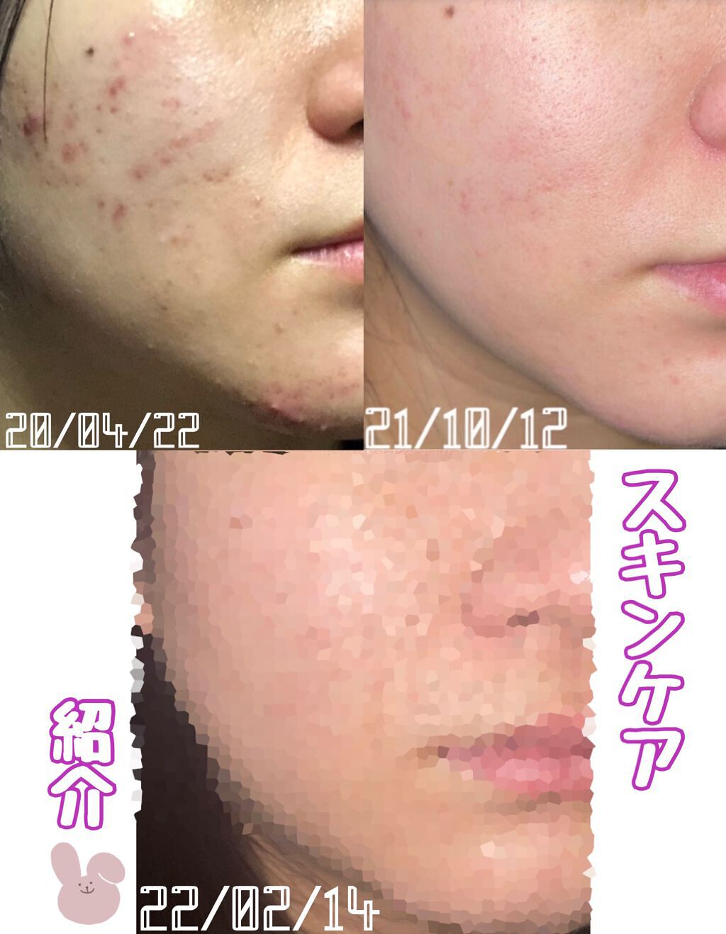 ビタライトビームエッセンシャルマスクEX/MEDIHEAL/シートマスク・パックを使ったクチコミ(1枚目)