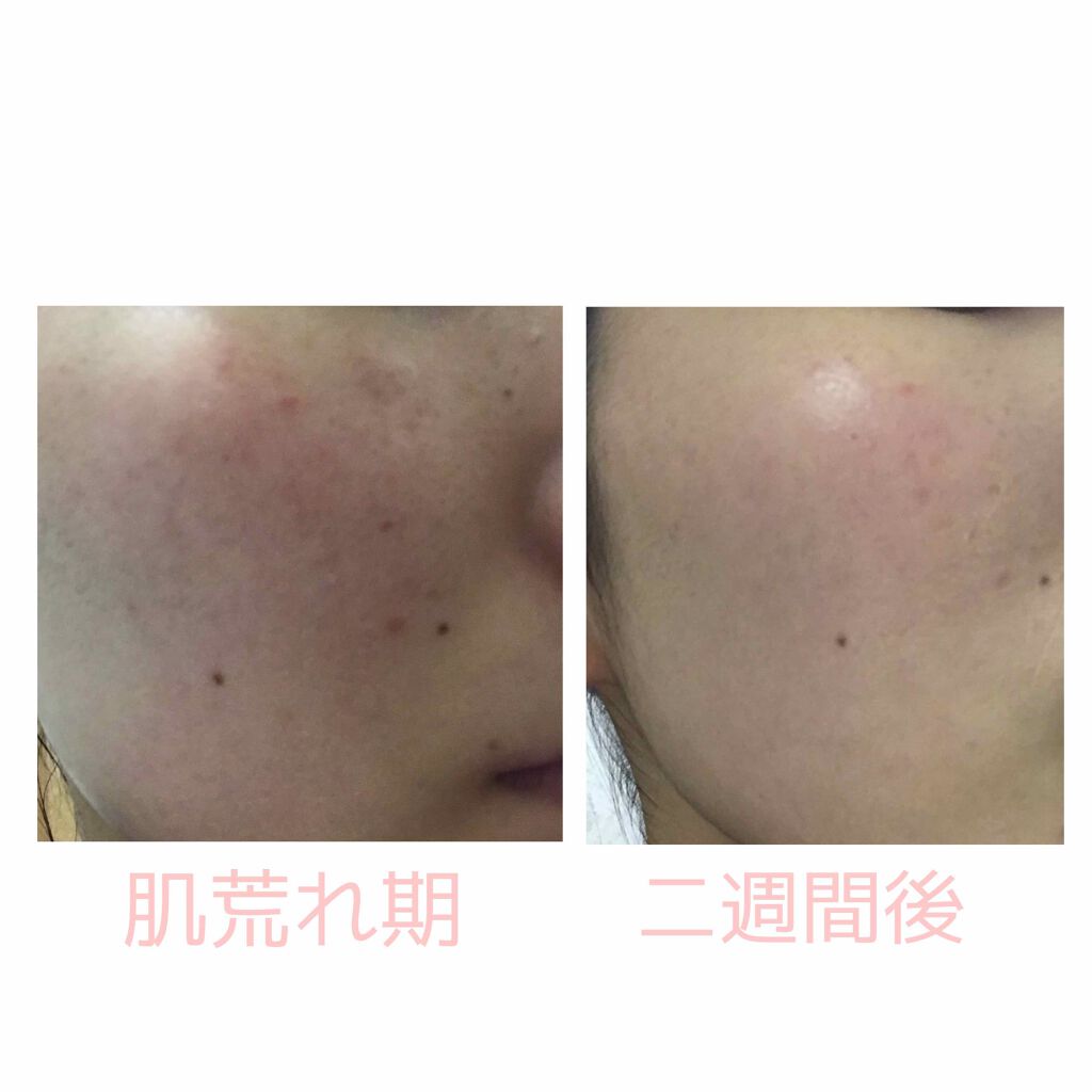 薬用美白乳液/なめらか本舗/乳液を使ったクチコミ（1枚目）