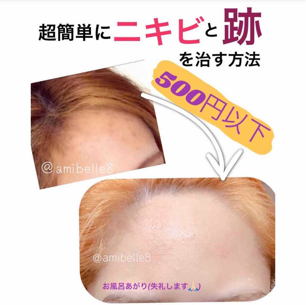 薬用洗顔フォーム/スキンライフ/洗顔フォームを使ったクチコミ（1枚目）