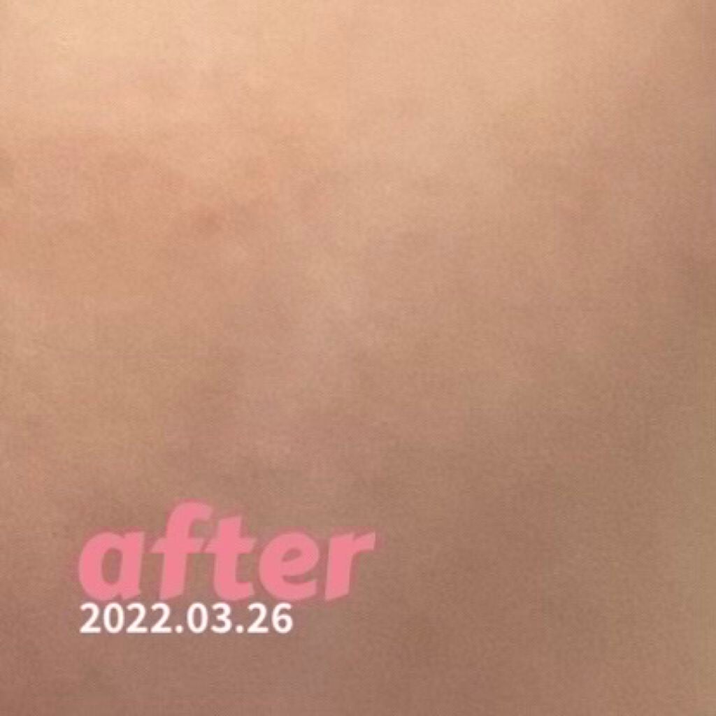 薬用しみ対策 美白化粧水/メラノCC/化粧水を使ったクチコミ(3枚目)