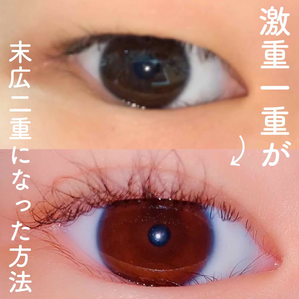 救急ばんそうこう/ドン・キホーテ/その他を使ったクチコミ（1枚目）