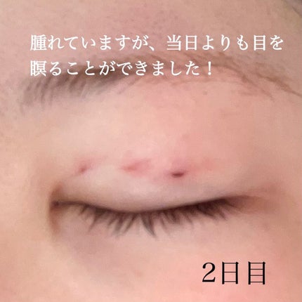 すぅ on LIPS 「私は、4年前から少しずつプチ整形も含めて、整形しています!20..」(6枚目)