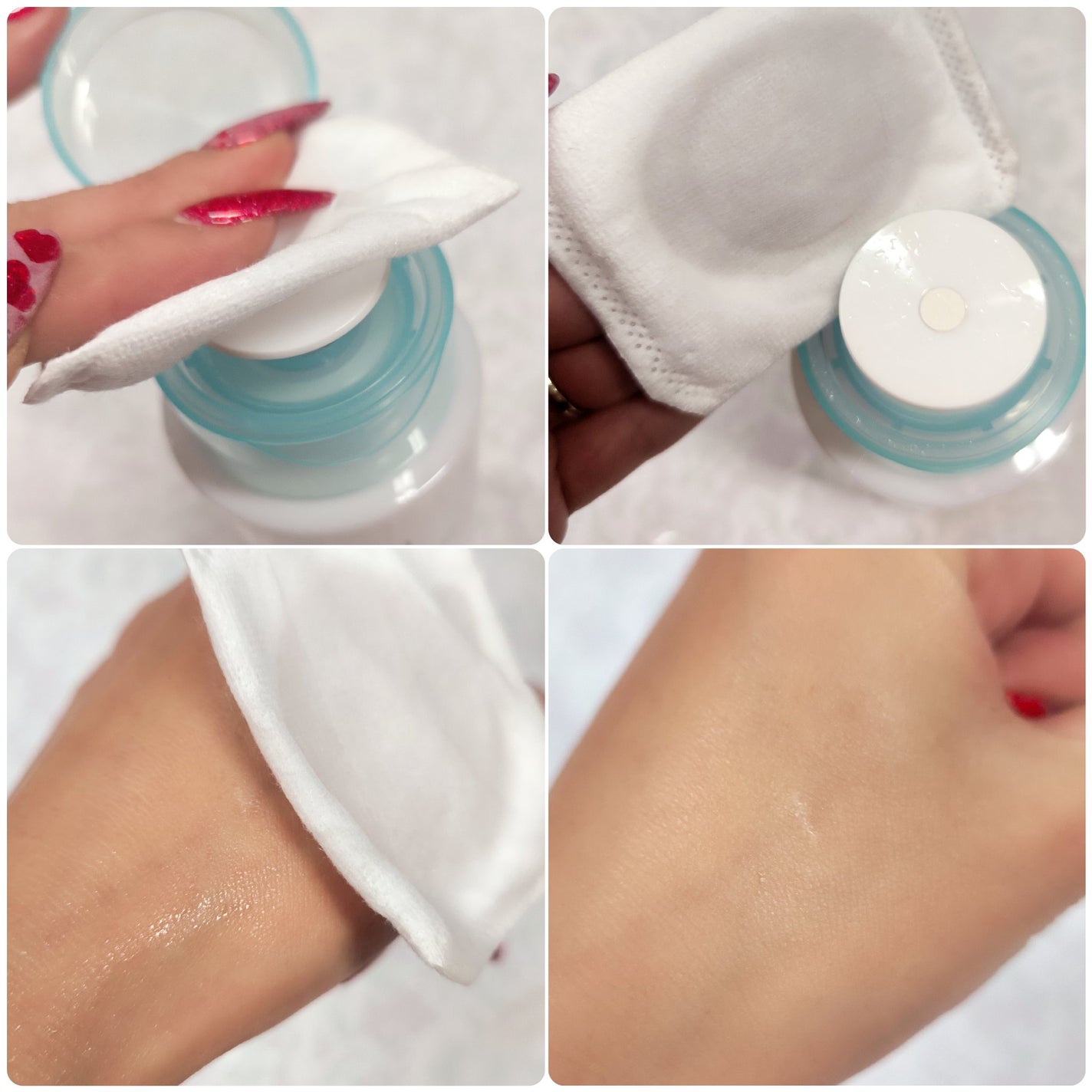 アキュネ 薬用ふきとりローションU/アキュネ/拭き取り化粧水を使ったクチコミ(3枚目)