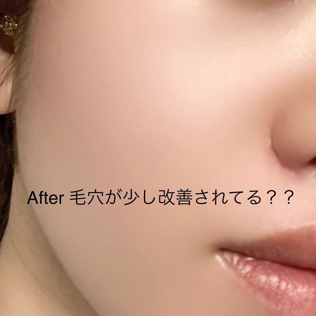 フルフィットプロポリスシナジートナー/COSRX/化粧水を使ったクチコミ(4枚目)