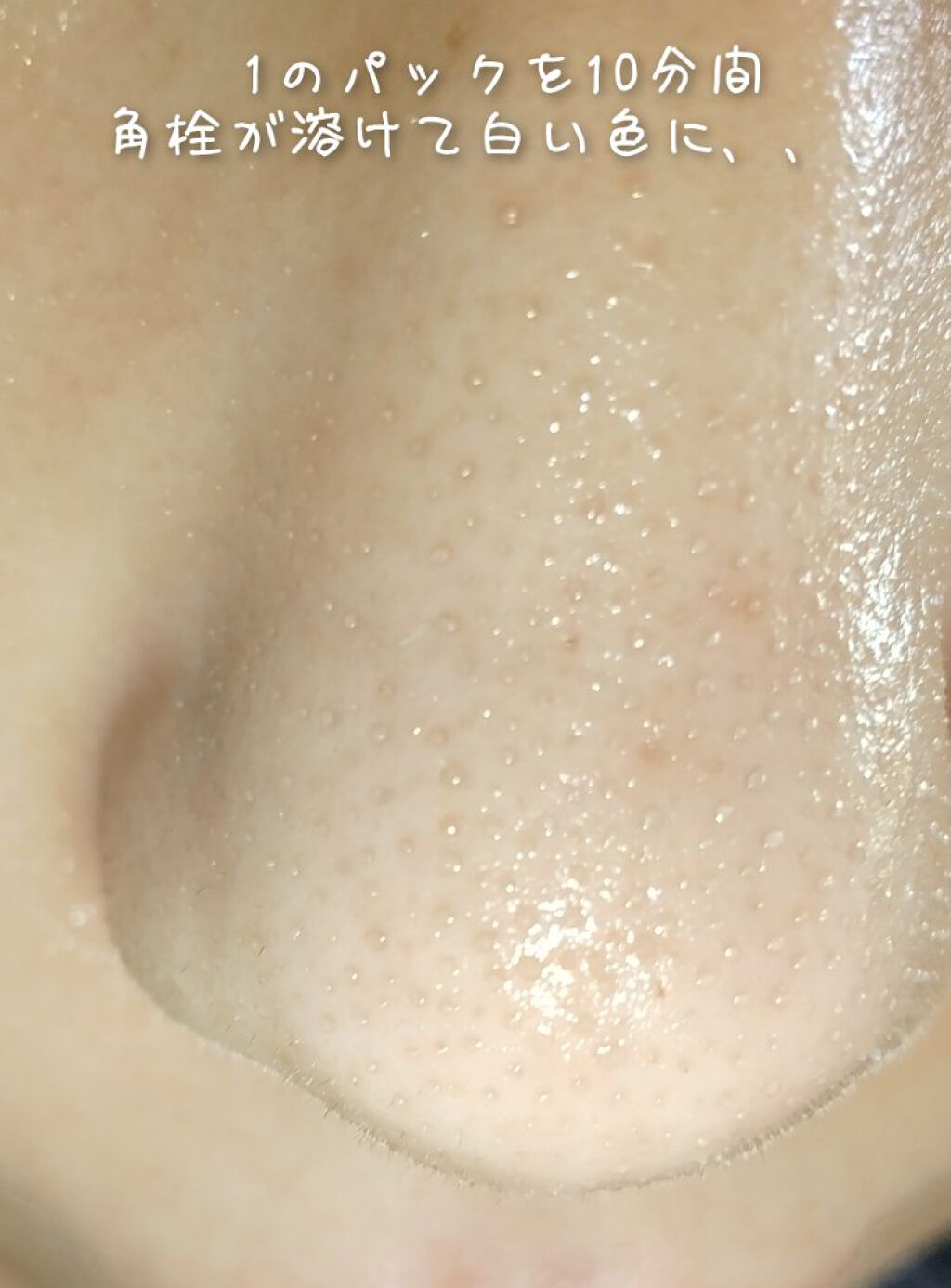 アンチポアブラックヘッドパーフェクトクリアキット/CNP Laboratory/シートマスク・パックを使ったクチコミ（3枚目）