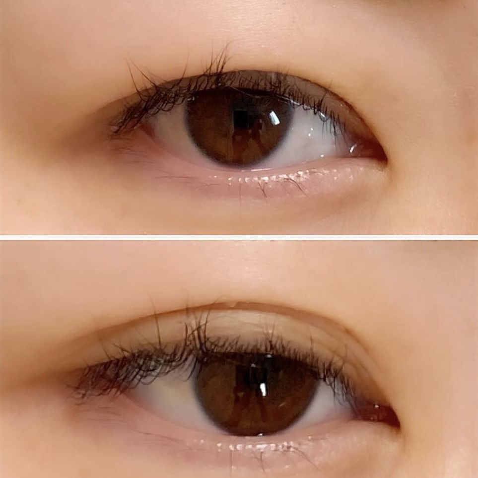 フリーファイバー120 スタンダードタイプ /メザイク/二重まぶた用アイテムを使ったクチコミ（3枚目）