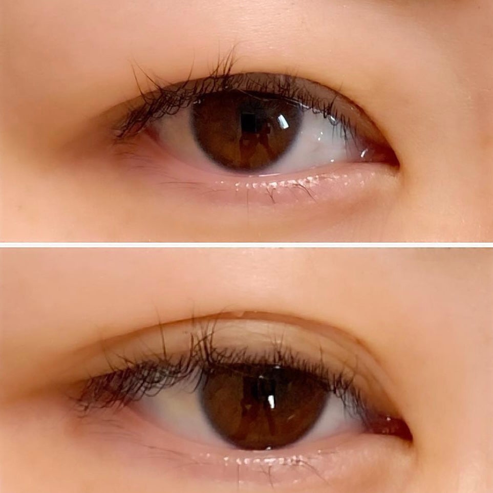 メザイク クリップ カッター ファイバー専用カッター/メザイク/二重まぶた用アイテムを使ったクチコミ(3枚目)