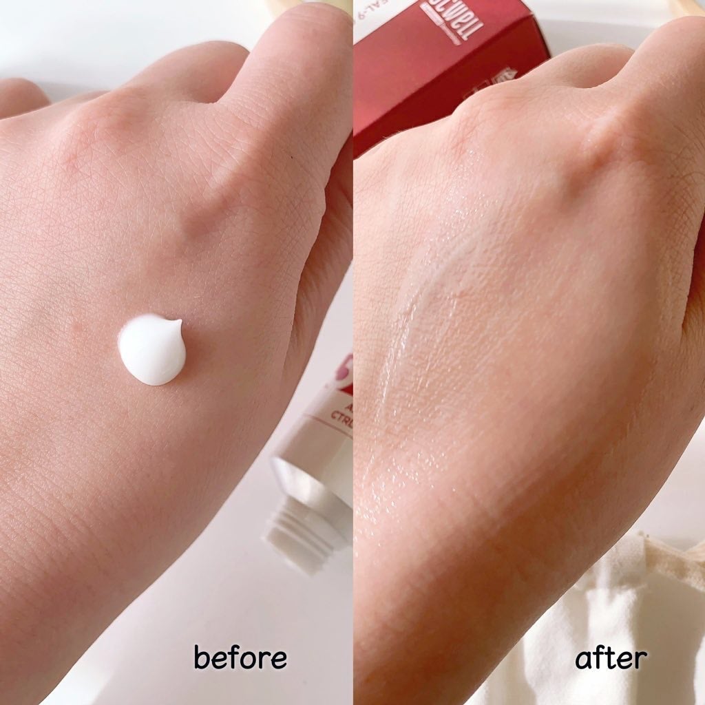 アキュリアルナインコントロールエックスクリーム/ACWELL/フェイスクリームを使ったクチコミ(3枚目)