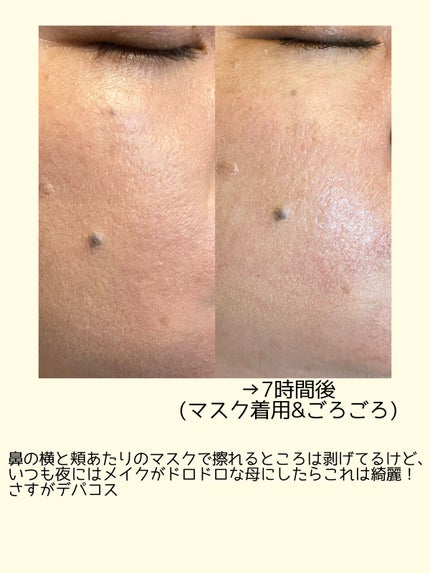 (旧)アンリミテッド ラスティング フルイド/shu uemura/リキッドファンデーションを使ったクチコミ(3枚目)