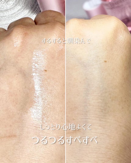 ピンクティーツリーシナジーセラム/APLIN/美容液を使ったクチコミ(5枚目)