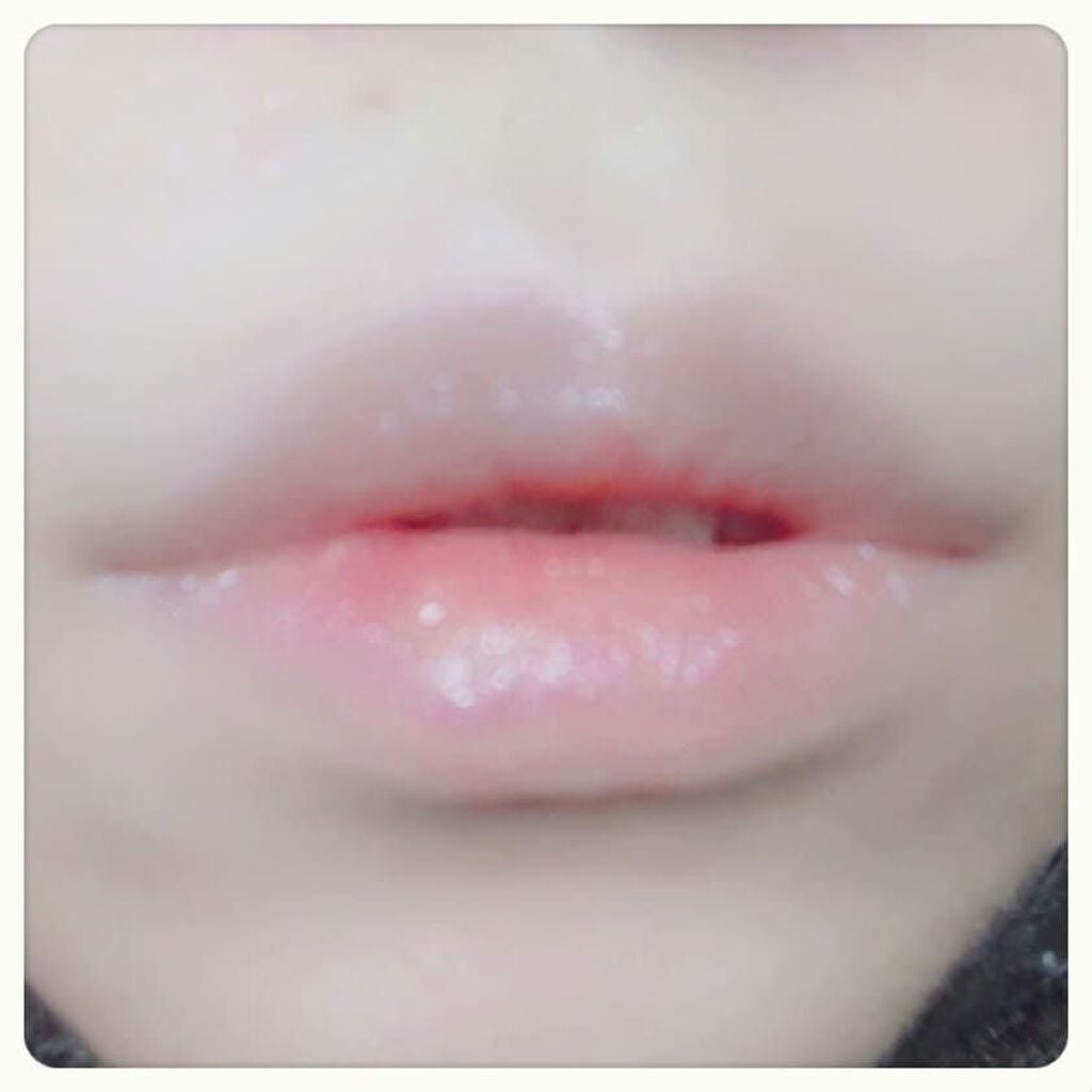 デンタルピルクリーム(医薬品)/メディケア/その他を使ったクチコミ(3枚目)