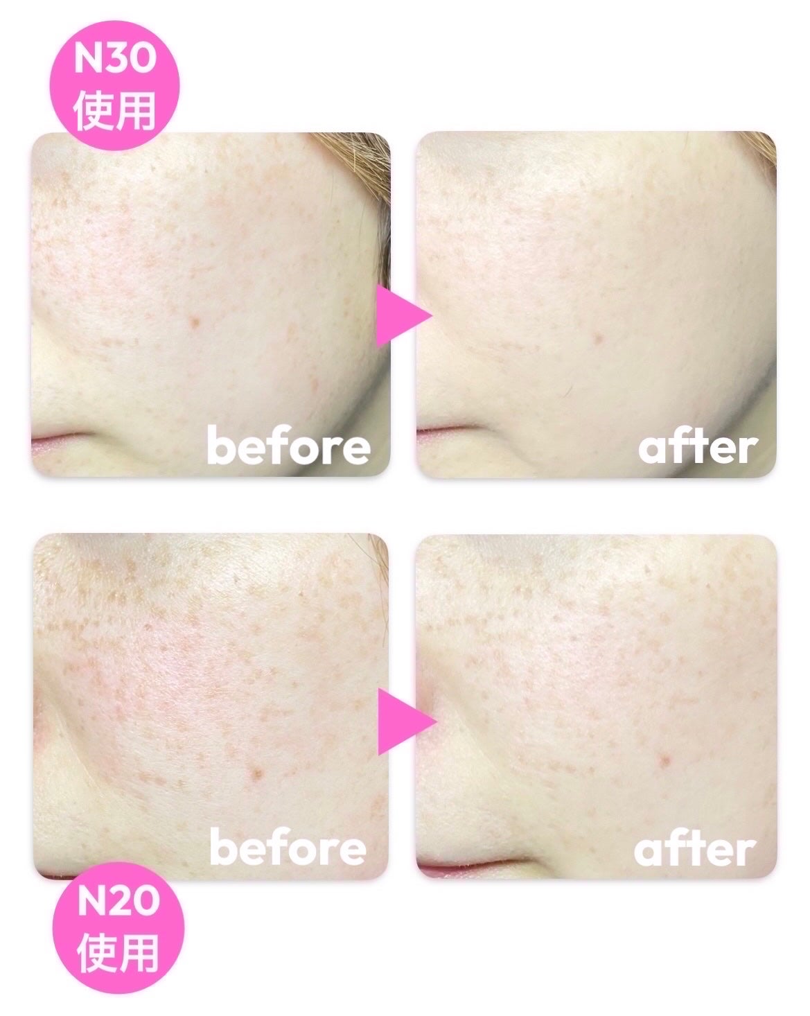 SPステイ ルミマット リキッド ファンデーション/MAYBELLINE NEW YORK/リキッドファンデーションを使ったクチコミ(8枚目)