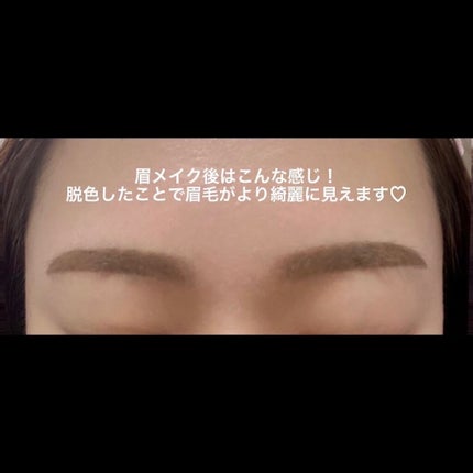 脱色クリーム 敏感肌用/エピラット/ムダ毛ケアを使ったクチコミ(6枚目)