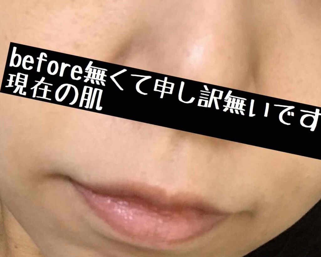 シミ・ソバカス予防ケア フェイスクリーム/キュレル/フェイスクリームを使ったクチコミ(2枚目)