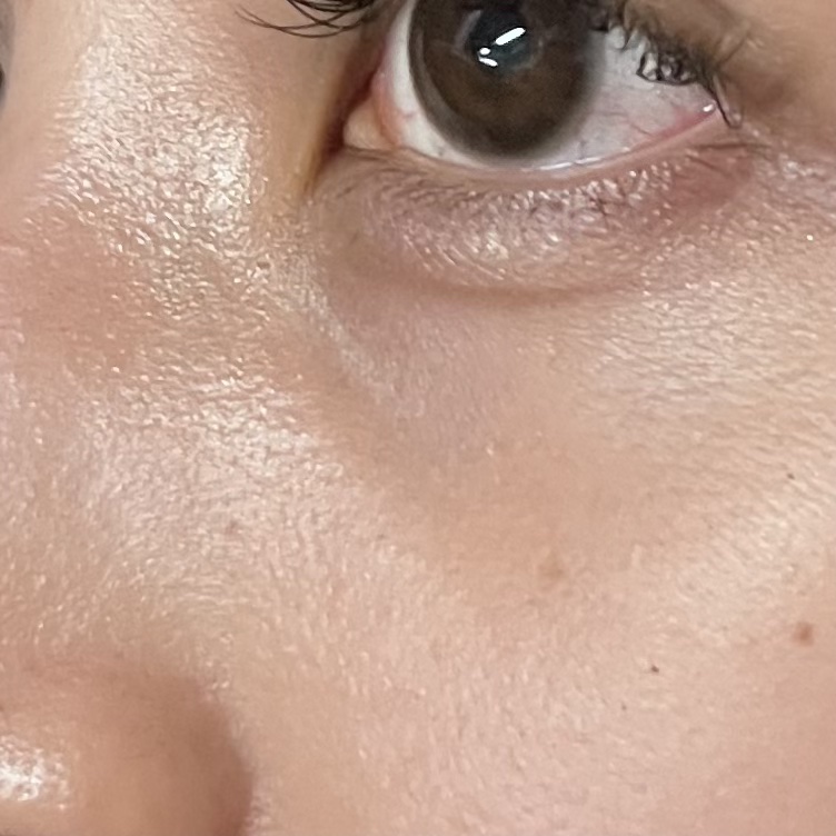 Glycolic Acid 7% Toning  Solution/The Ordinary/ブースター・導入液を使ったクチコミ（1枚目）