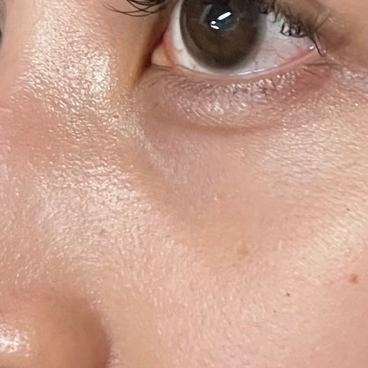 Glycolic Acid 7% Toning Solution/The Ordinary/ブースター・導入液を使ったクチコミ(1枚目)