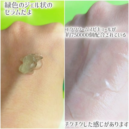 ポアセラショットエクソソームスピキュールセラム& ミニマイザー美顔/MEDITHERAPY/美容液を使ったクチコミ(3枚目)