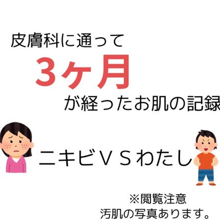ディフェリンゲル0.1% /マルホ株式会社/その他を使ったクチコミ(1枚目)