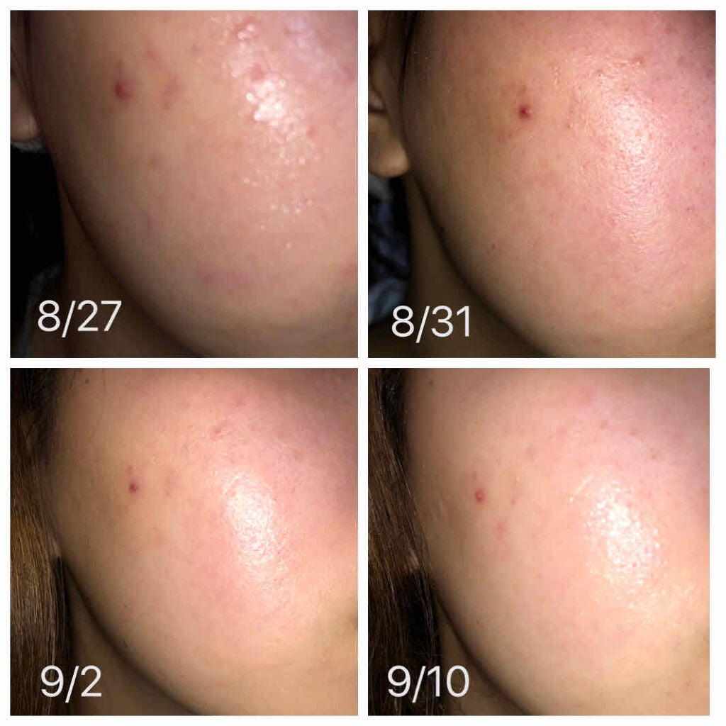 メルライン/Dr.Mineral/オールインワン化粧品を使ったクチコミ(3枚目)