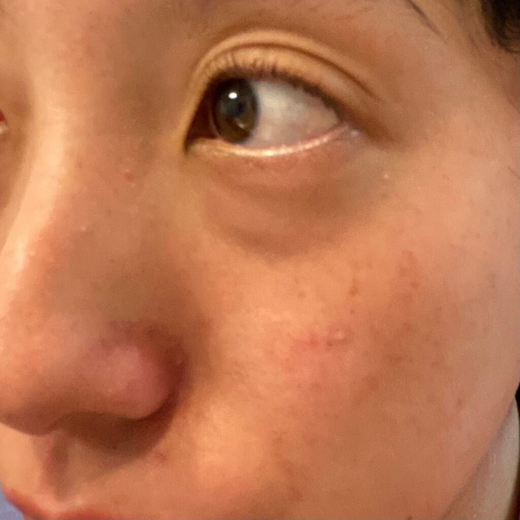 ハトムギ化粧水(ナチュリエ スキンコンディショナー R )/ナチュリエ/化粧水を使ったクチコミ(4枚目)