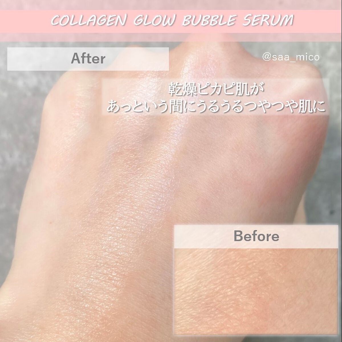 コラーゲンバブルセラム/MEDICUBE/美容液を使ったクチコミ(6枚目)